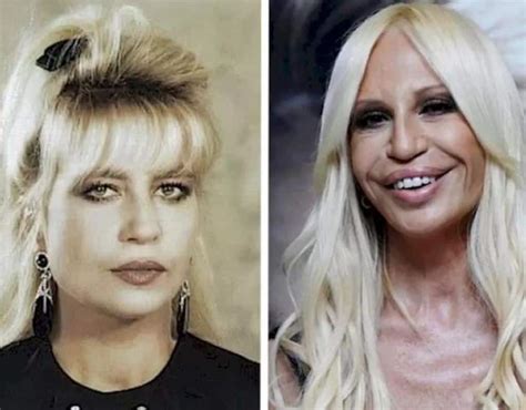 abbigliamento versace donna|what happened to donatella versace's face.